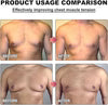 Gynecomastia Heating Oil