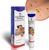 Warts Remover